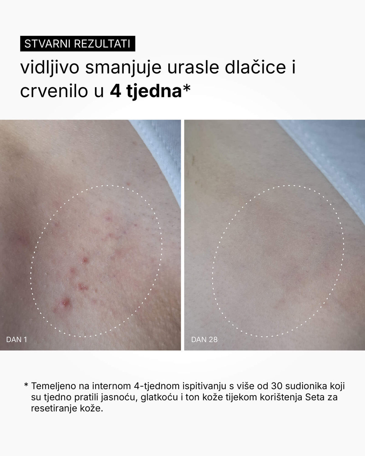 Skin Reset Set - Volledige routine voor het lichaam