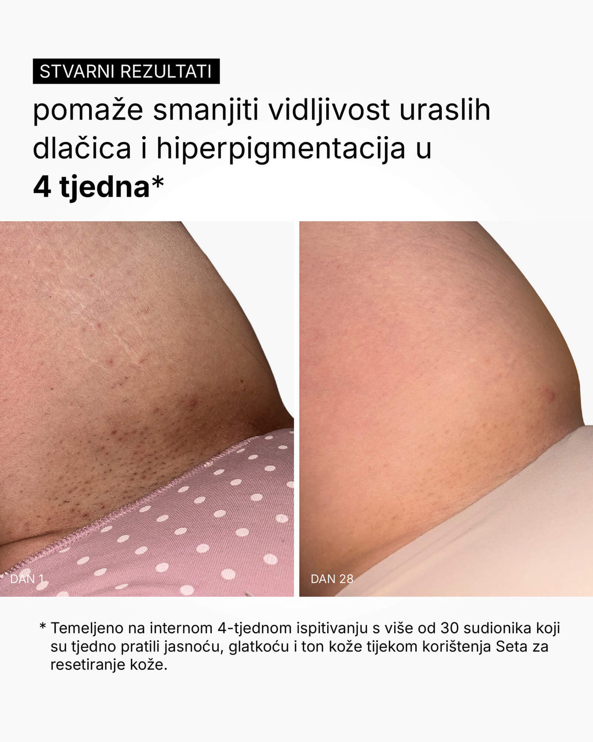Skin Reset Set - Volledige routine voor het lichaam