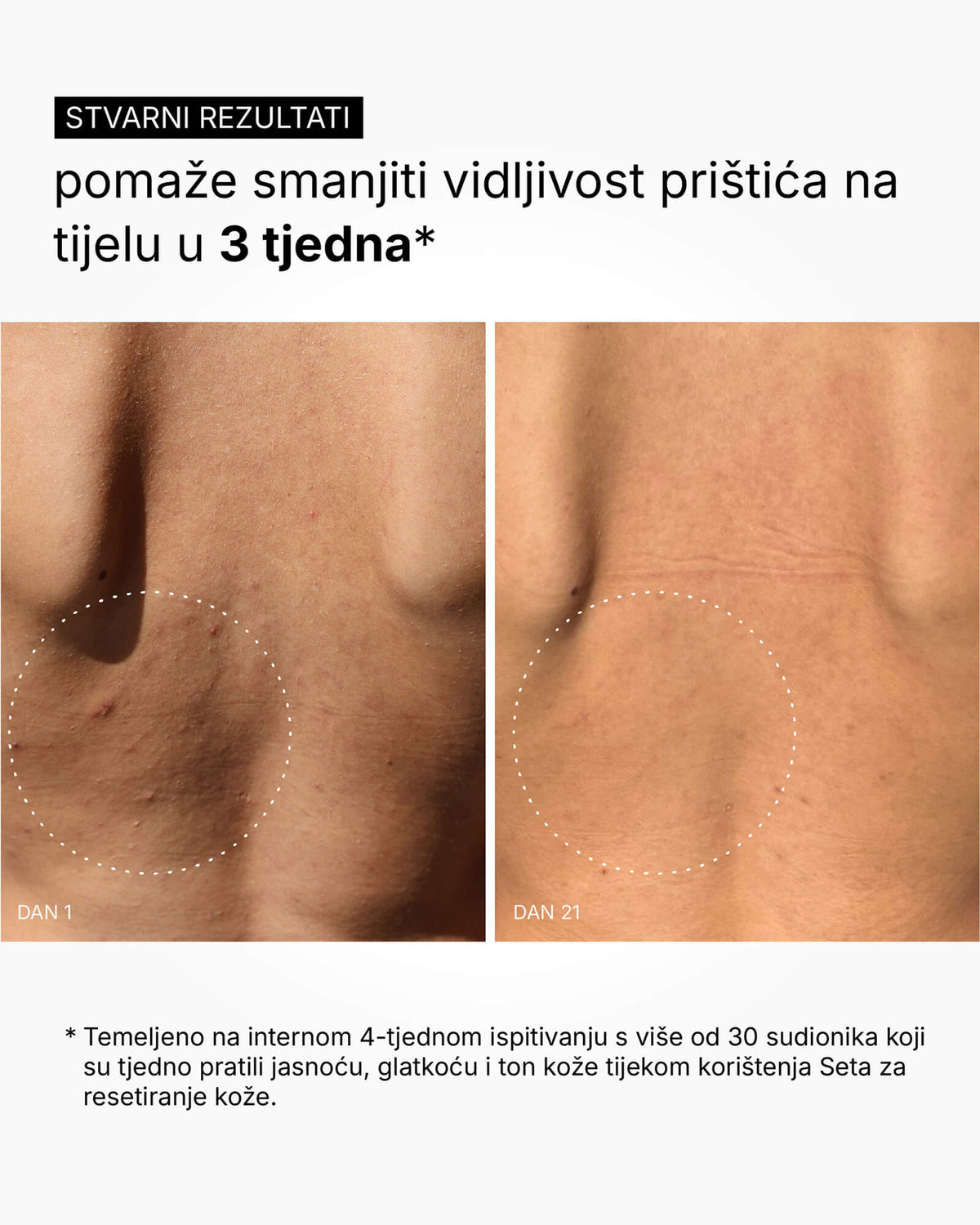 Skin Reset Set - Volledige routine voor het lichaam