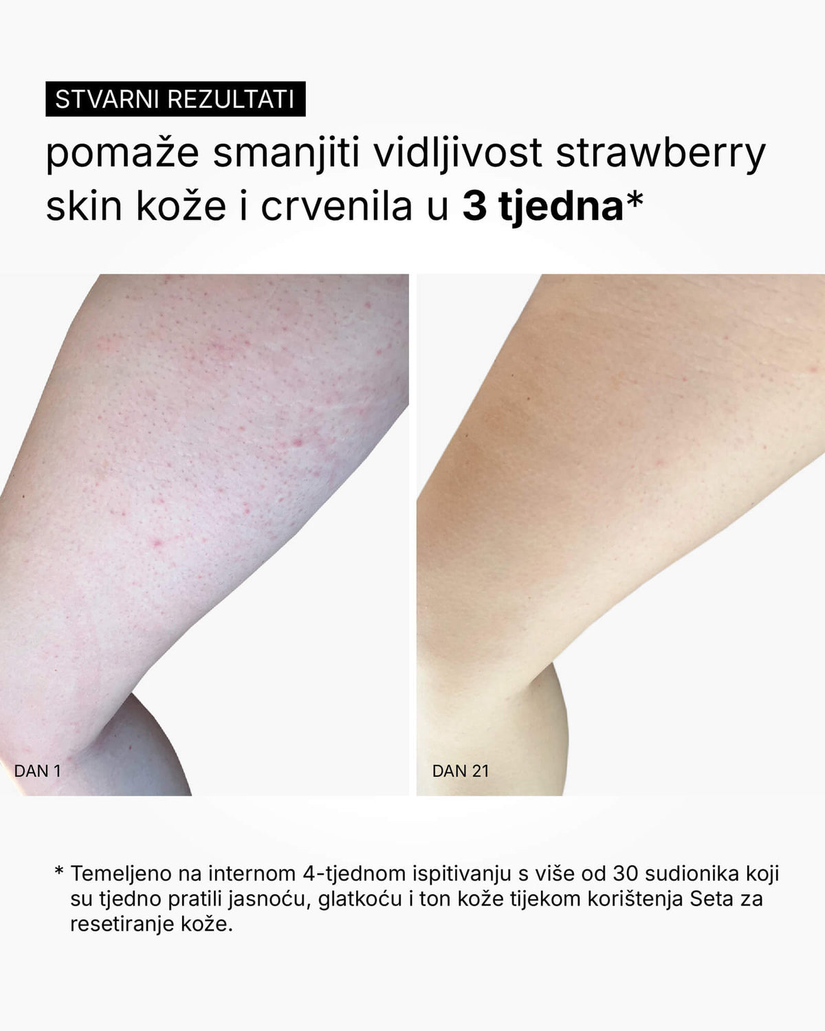 Skin Reset Set - Volledige routine voor het lichaam