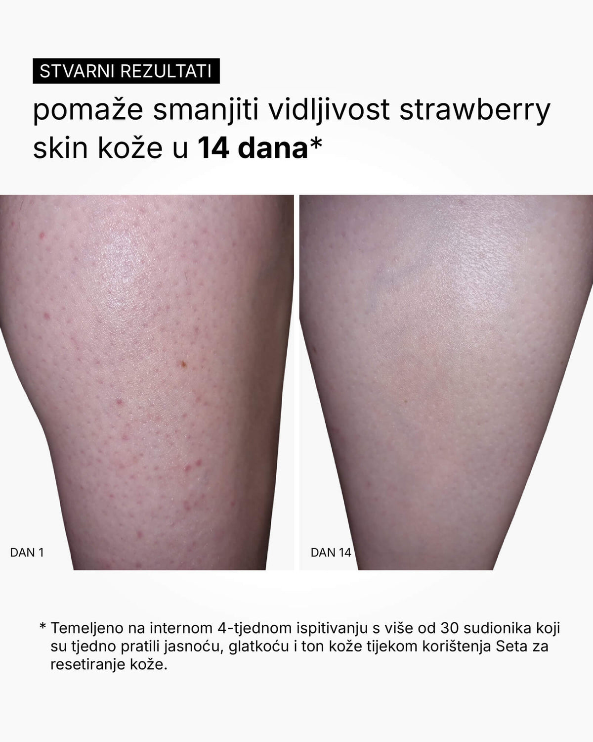 Skin Reset Set - Volledige routine voor het lichaam
